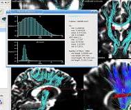 MedINRIA | medical diagnosis