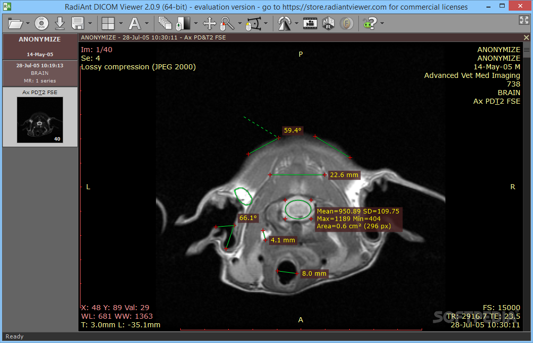 Radiant dicom viewer crack. Radiant Dicom. Radiant Dicom viewer. Радиант программа для рентгенолога. Программа Радиант для просмотра кт.